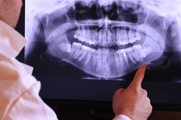 Best Emergency Treatment for Toothache in Mcdonald, PA